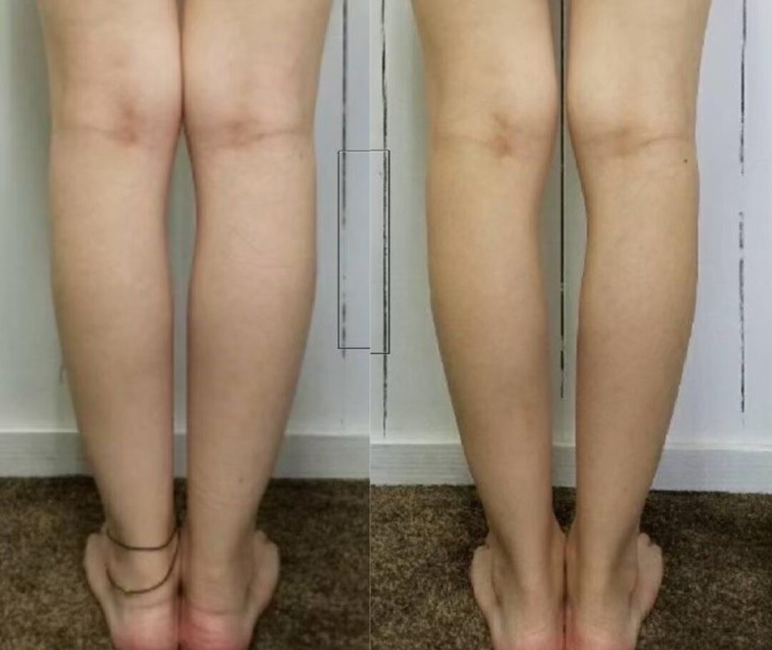 整体・骨盤矯正