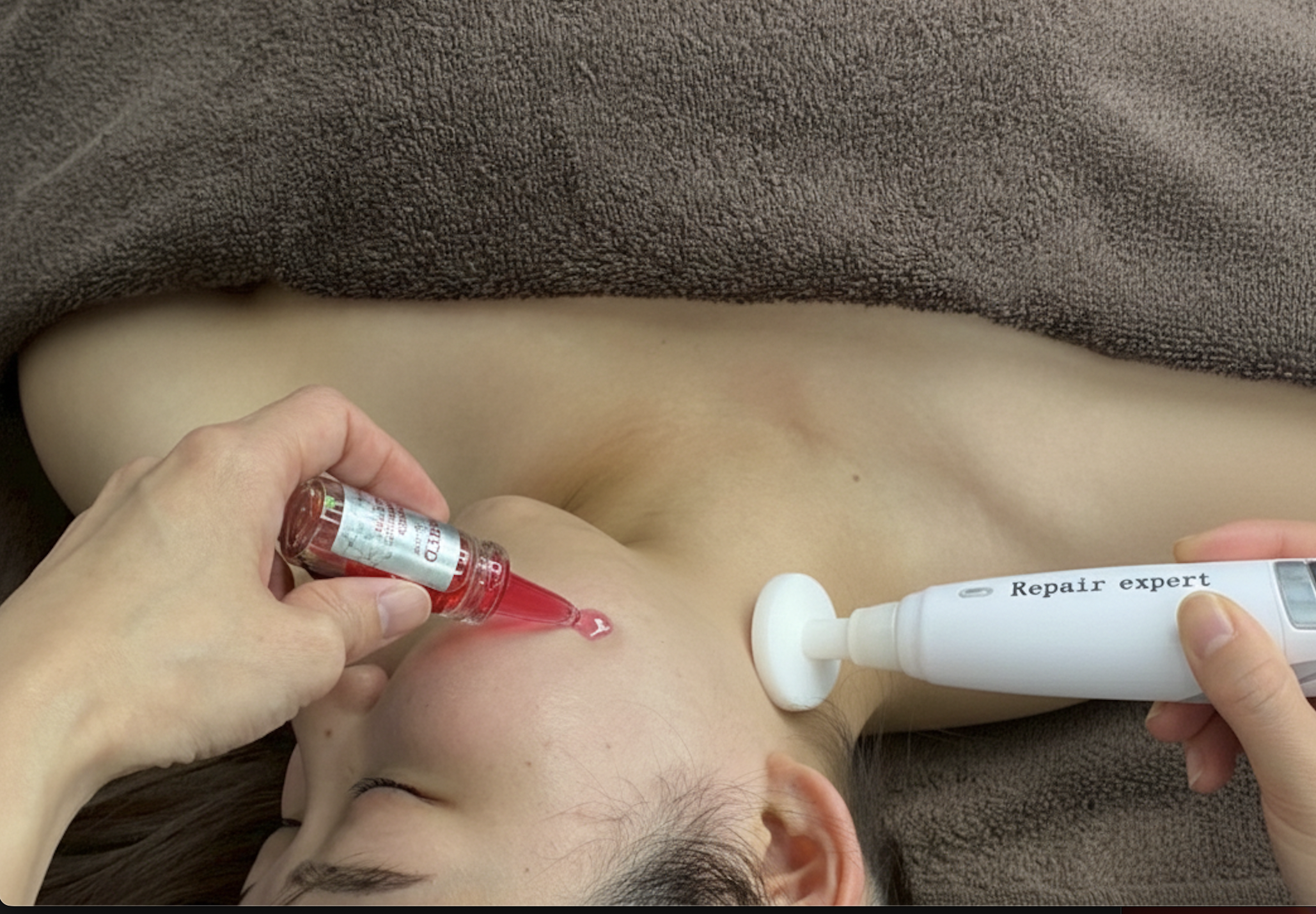 RED SHOT施術の様子